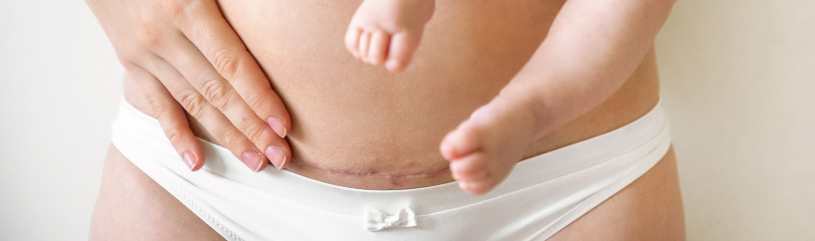 Pilates for Caesarean Recovery
